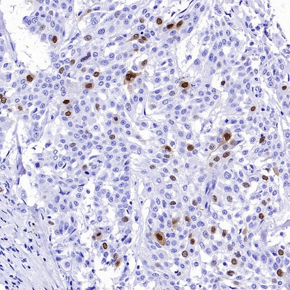 Cyclin A2 Recombinant Rabbit mAb (S-2554-2)