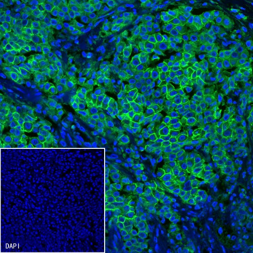 ErbB2 Recombinant Rabbit mAb (Alexa Fluor® 488 Conjugate) (SDT-069-57)