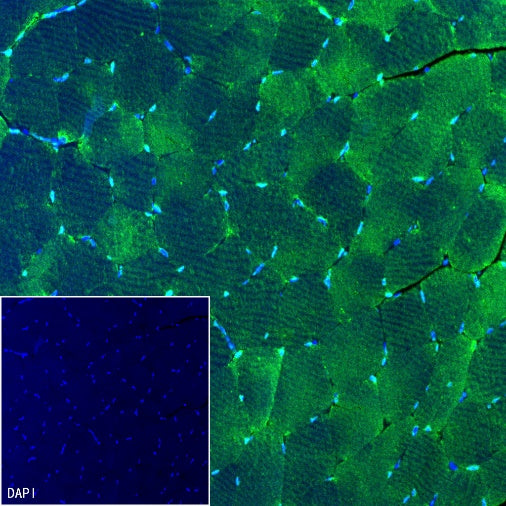 TRIM63 Recombinant Rabbit mAb (S-2304-110)
