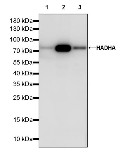 HADHA Recombinant Rabbit mAb (S-2345-8)