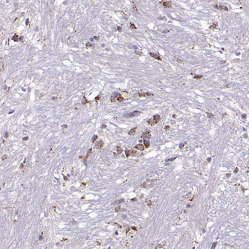 Man6P Recombinant Rabbit mAb (S-2745)