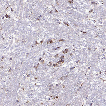 Man6P Recombinant Rabbit mAb (S-2745)