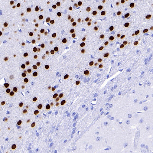 TBR1 Recombinant Rabbit mAb (S-1102-34)