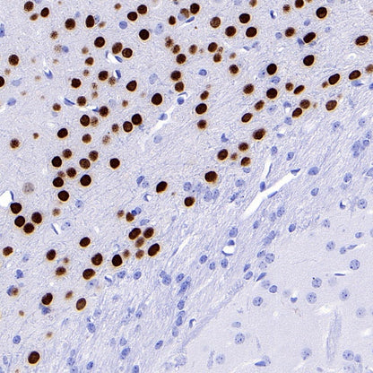 TBR1 Recombinant Rabbit mAb (S-1102-34)