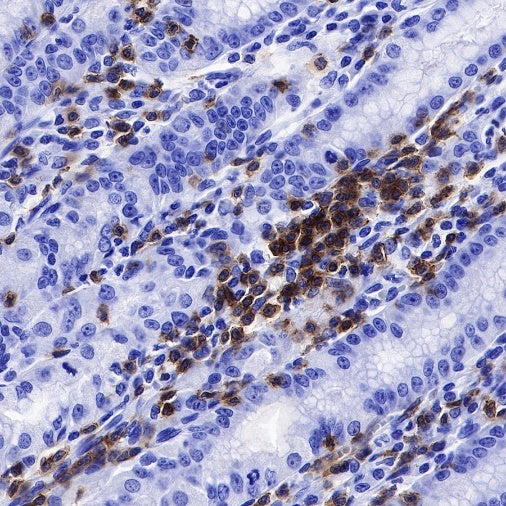 Lck Recombinant Rabbit mAb (SDT-316-15)