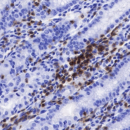 Lck Recombinant Rabbit mAb (SDT-316-15)