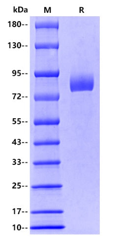 IL-1R2/CD121b hFc Tag Protein, Human