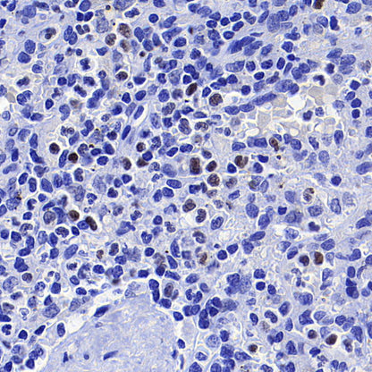 CEBPA Recombinant Rabbit mAb (S-3629-33)