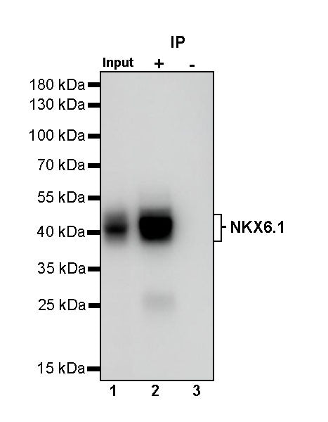 NKX6.1 Recombinant Rabbit mAb (S-260-31)