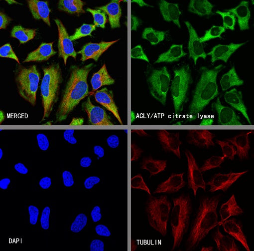 ACLY/ATP citrate lyase Recombinant Rabbit mAb (S-2025-32)