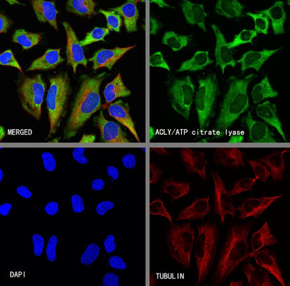 ACLY/ATP citrate lyase Recombinant Rabbit mAb (S-2025-32)