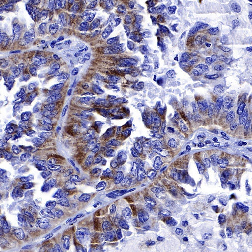 EGFR (delE746-A750) Recombinant Rabbit mAb (S-451-168)