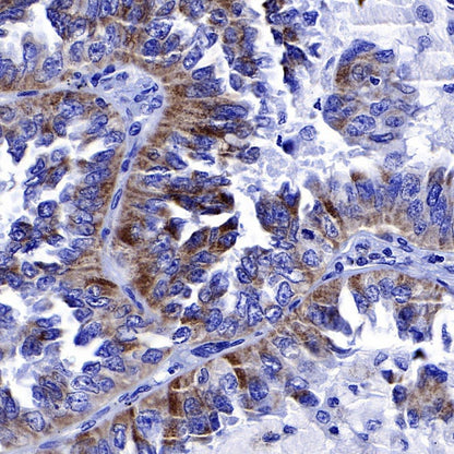 EGFR (delE746-A750) Recombinant Rabbit mAb (S-451-168)