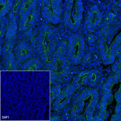 E-Cadherin Recombinant Rabbit mAb (FITC Conjugate) (S-438-5)