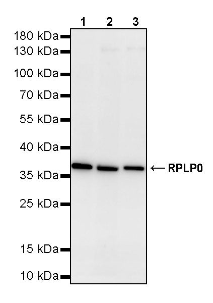 RPLP0 Rabbit Polyclonal Antibody