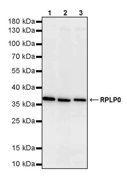 RPLP0 Rabbit Polyclonal Antibody