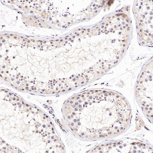TDG Recombinant Rabbit mAb (S-3111-16)