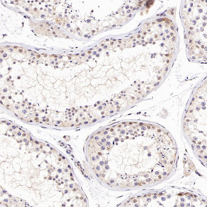 TDG Recombinant Rabbit mAb (S-3111-16)