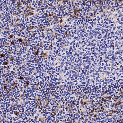 TIM-3 Recombinant Rabbit mAb (S-1450-21)