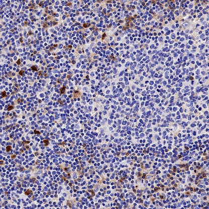 TIM-3 Recombinant Rabbit mAb (S-1450-21)