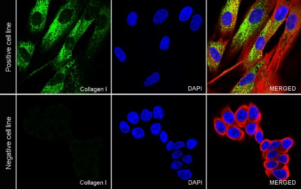 Collagen I Recombinant Rabbit mAb (S-1473-5)