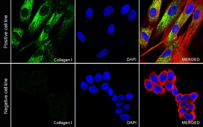 Collagen I Recombinant Rabbit mAb (S-1473-5)