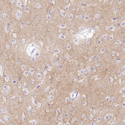 Versican Recombinant Rabbit mAb (S-3770-43)