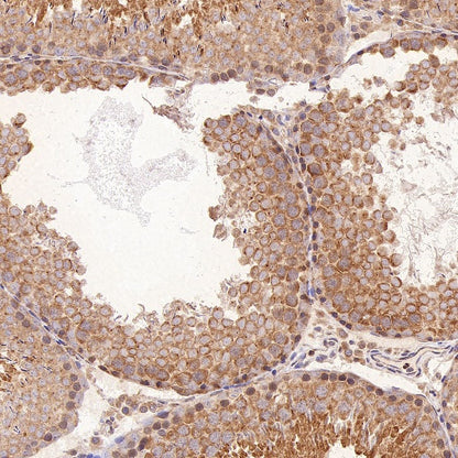 eIF4E Rabbit Polyclonal Antibody