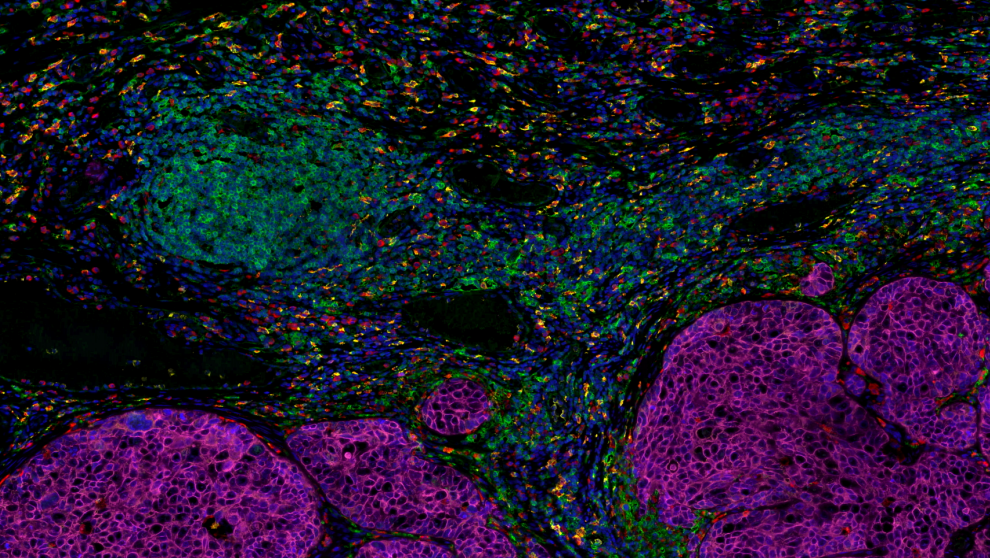 Absin 5-Color IHC Kit (Anti-Rabbit and Mouse Secondary Antibody)