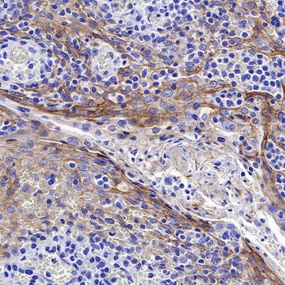 Nectin-4 Recombinant Rabbit mAb (SDT-277-314-1)