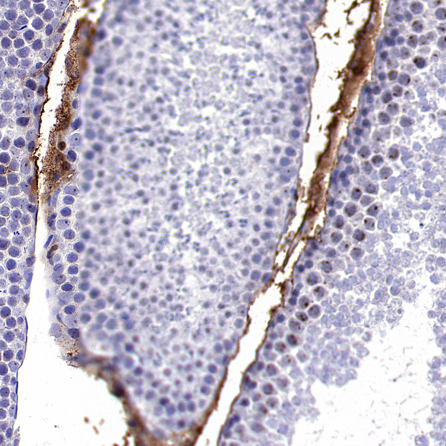 TRFE Rabbit Polyclonal Antibody
