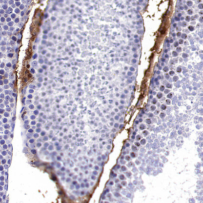 TRFE Rabbit Polyclonal Antibody