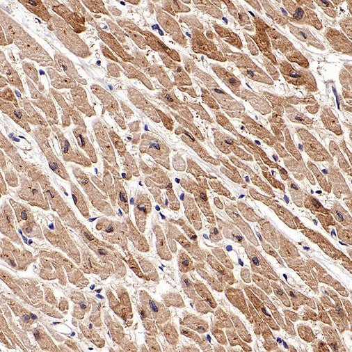 PKA C-α Recombinant Rabbit mAb (S-2564-5)