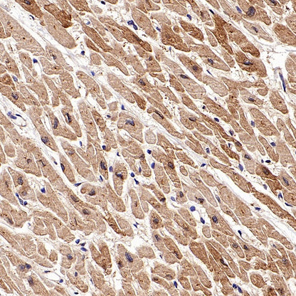 PKA C-α Recombinant Rabbit mAb (S-2564-5)