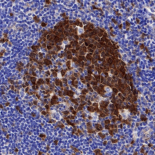 CDK1 Recombinant Rabbit mAb (S-1374-66)