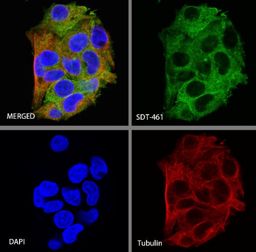ACSL4/FACL4 Recombinant Rabbit mAb (S-461-6)