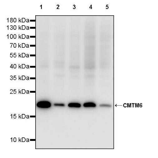 CMTM6 Recombinant Rabbit mAb (S-2013-4)