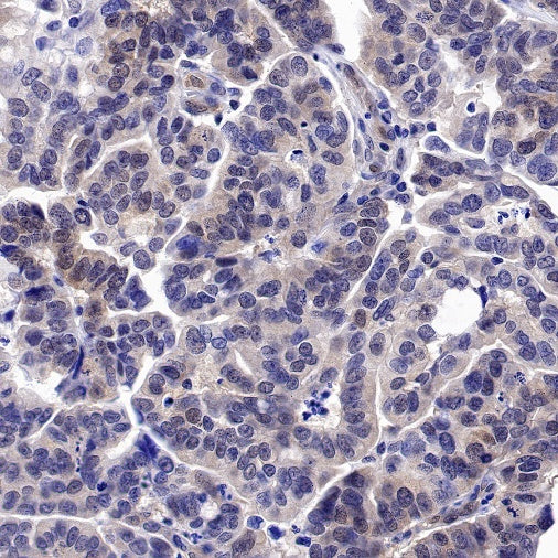 JNK1 Recombinant Rabbit mAb (S-1153-21)