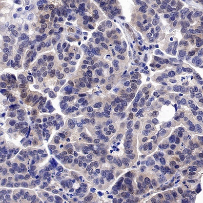 JNK1 Recombinant Rabbit mAb (S-1153-21)