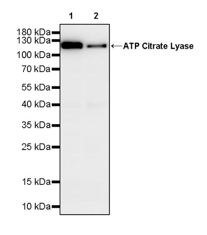 ATP Citrate Lyase Recombinant Rabbit mAb (S-5036)