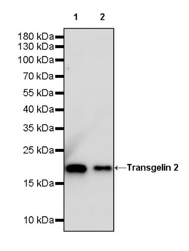 Transgelin 2 Recombinant Rabbit mAb (S-2809-73)