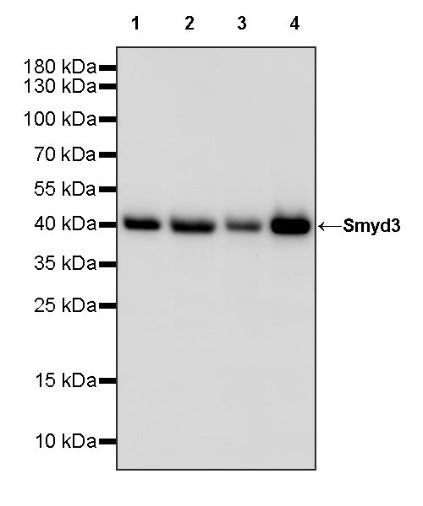 Smyd3 Recombinant Rabbit mAb (S-1507-61)