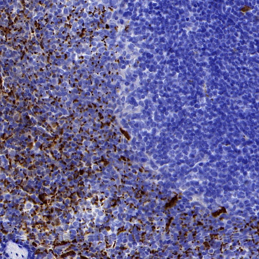 S-RMab® Factor XIIIa Recombinant Rabbit mAb (SDT-R278)