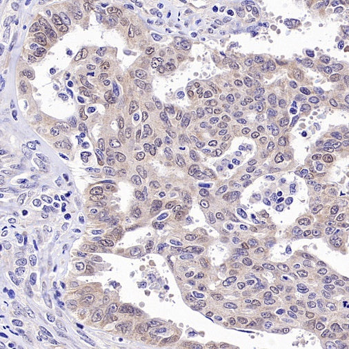 Caspase-2 Recombinant Rabbit mAb (S-3188-3)