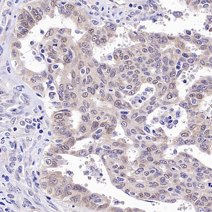 Caspase-2 Recombinant Rabbit mAb (S-3188-3)