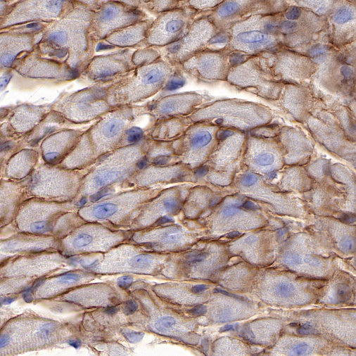 Dystrophin Recombinant Rabbit mAb (S-090-327)