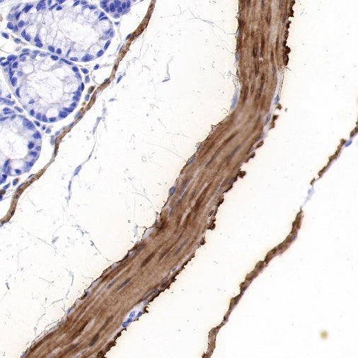 Calponin-1 Recombinant Rabbit mAb (S-R161)