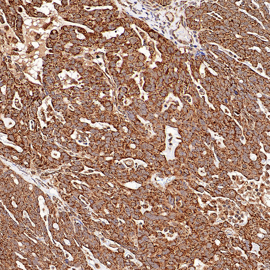GOT2 Recombinant Rabbit mAb