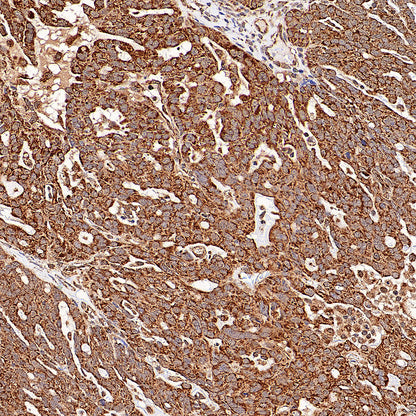 GOT2 Recombinant Rabbit mAb