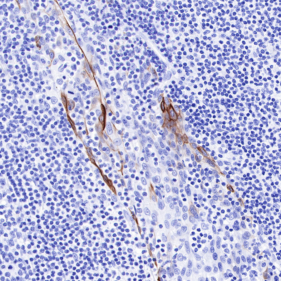 Keratin 17 Recombinant Rabbit mAb (SDT-011-43)